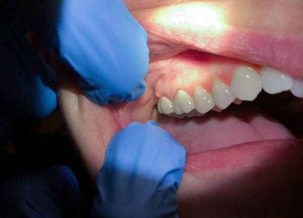 Best Same-Day Emergency Dentist in Towanda, KS